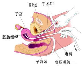 道县丽人妇科医院